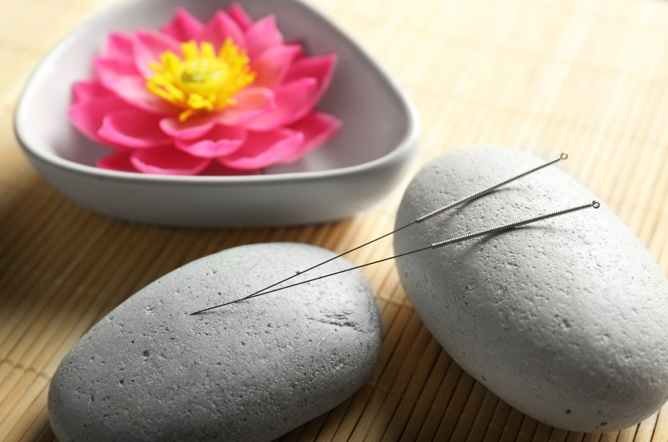 Acupuncture Needles on Massage Stone with Lotus in Background
